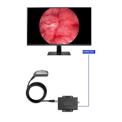 4K UHD Portable Medical Camera System Endoscope Image Processor For Mac Windows Monitor