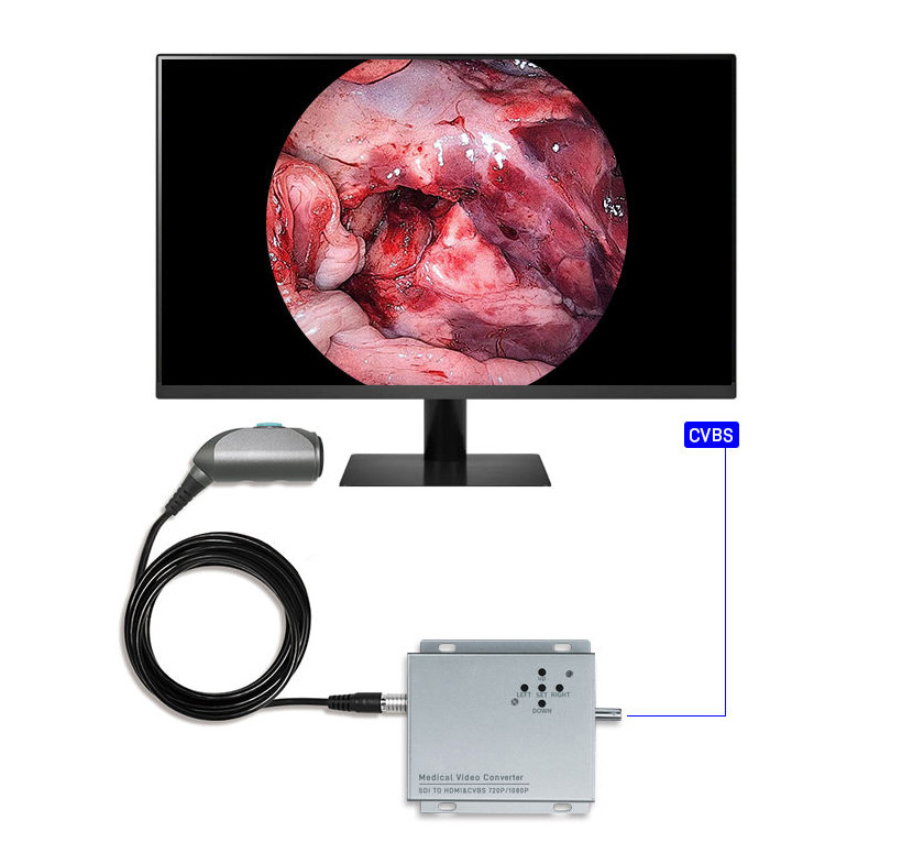 Processeur vidéo pour endoscopie Caméra portable Ent 1080p HDMI Sortie CVBS