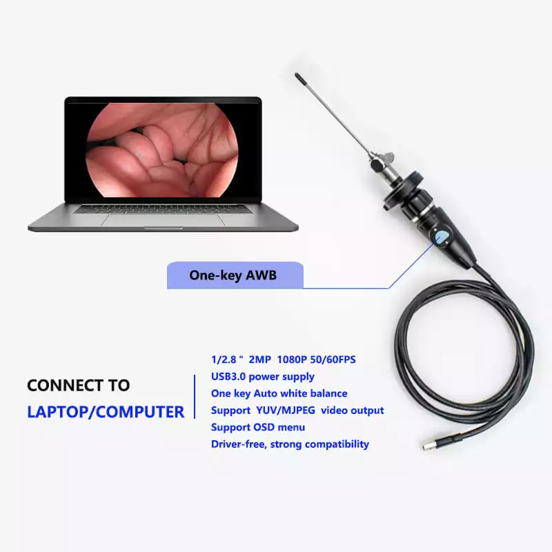 USB3.0 1080p Full HD Médical Endoscopique Portable Caméra CMOS Haute Résolution Pour ORL Laparoscope Gynécologie