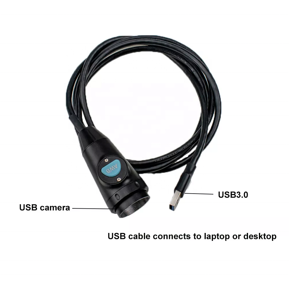 USB3.0 1080p Full HD Medical Portable Endoscopic High Resolution CMOS Endoscope Camera For ENT Laparoscope Gynecology