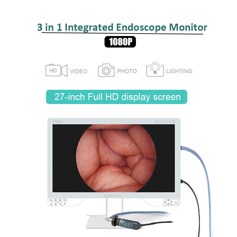 27inch 1080p Medical Endoscopy EquipmENT With Light Source For Laparoscopic Hysteroscope Cystoscope Surgery
