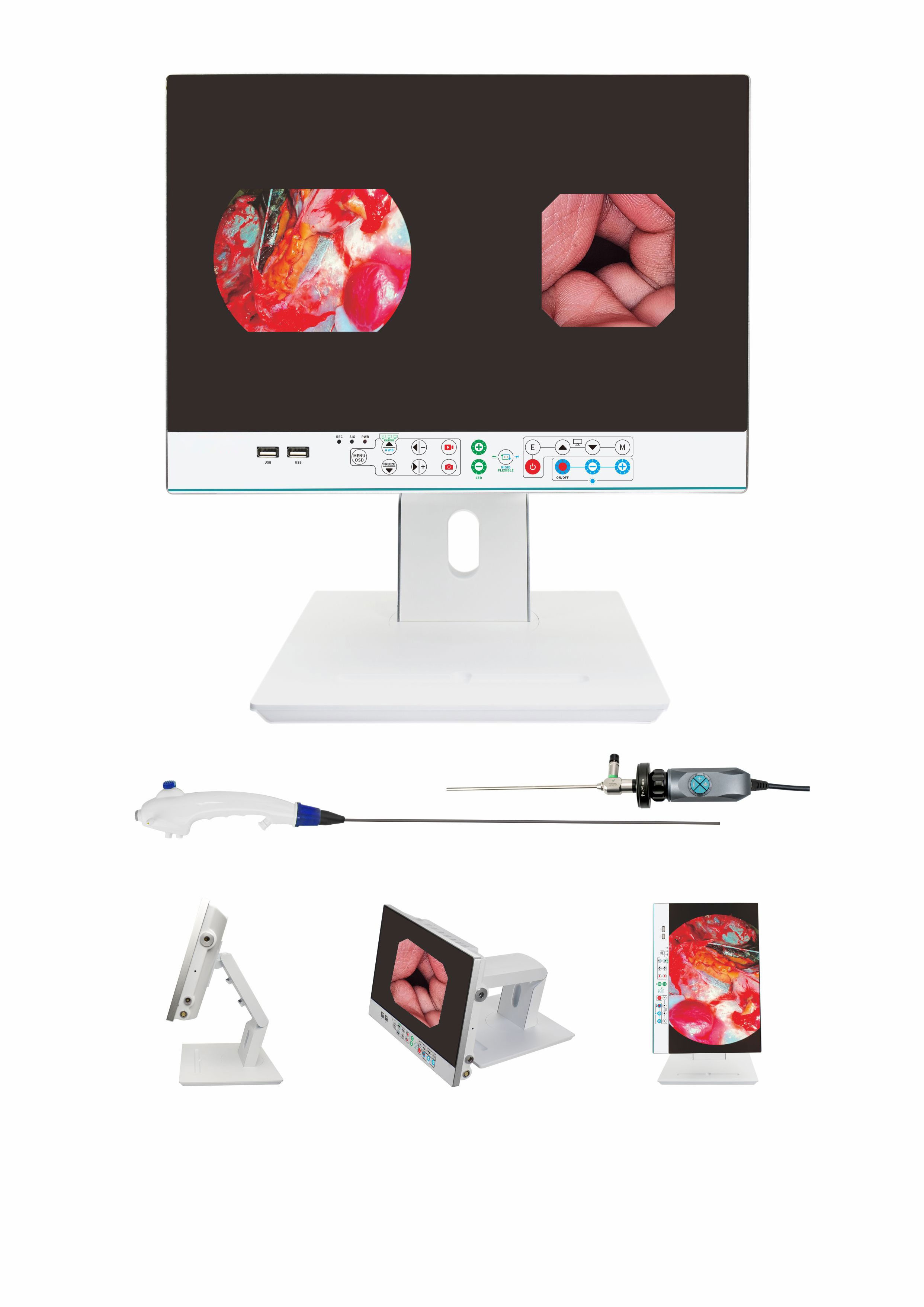 4K UHD LCD Monitor Medical Endoscopy Camera With Light Source USB Record For Laparoscope Spine Arthroscopy