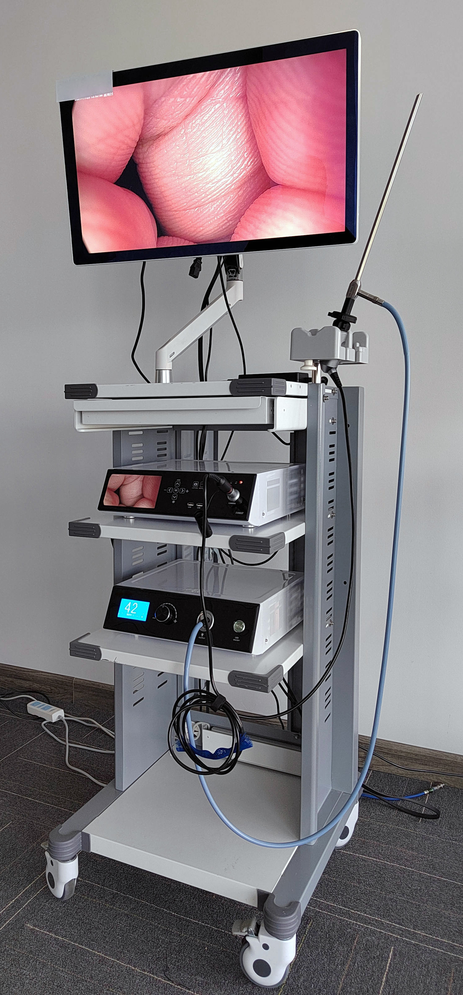 Full HD Medical Endoscopy Camera With USB Video Record 120W Light Source For Surgery Laparoscopy Arthroscope Gynecology