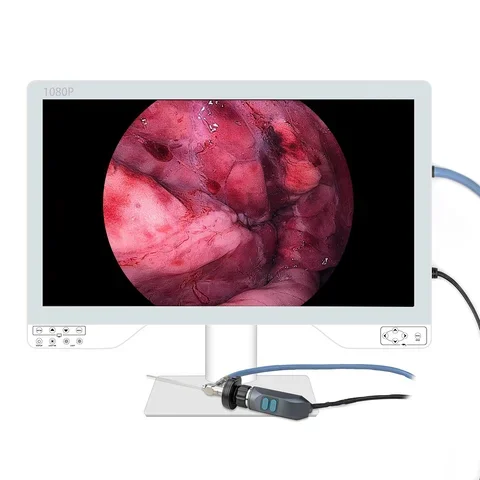 27inch 1080p Medical Endoscopy EquipmENT With Light Source For Laparoscopic Hysteroscope Cystoscope Surgery
