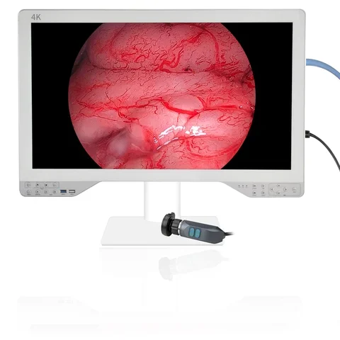 27inch All In One Ultra HD 4K Medical Grade Monitor For Endoscope Laparoscopic System With Optic Light Source