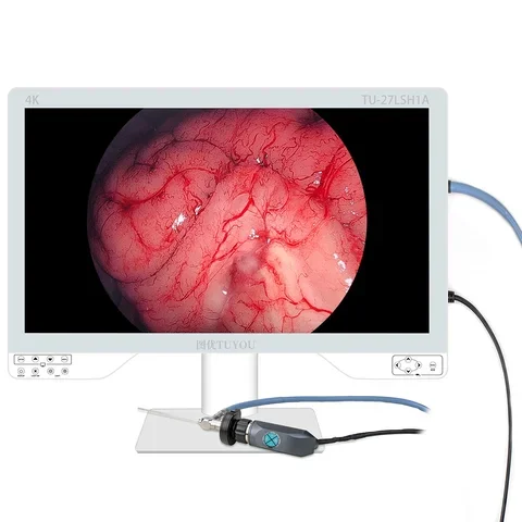 Ultra HD 4K Medical Endoscope Camera Imaging System Surgical Monitor