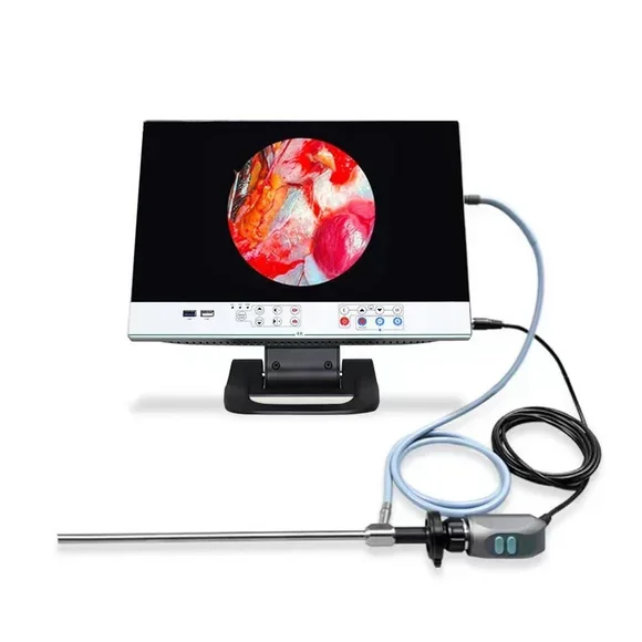 15.6 Inch Medical Camera System Full HD Endoscope Camera For Gynecology Laparoscope Spine Arthroscope