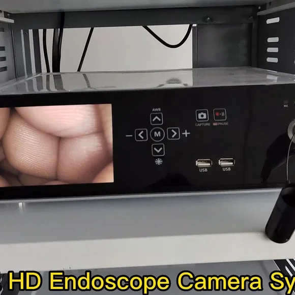 1080p Video Endoscopy Machine Medical Endoscope Camera For Laparoscope Spine Arthroscope Gynecological With USB Record