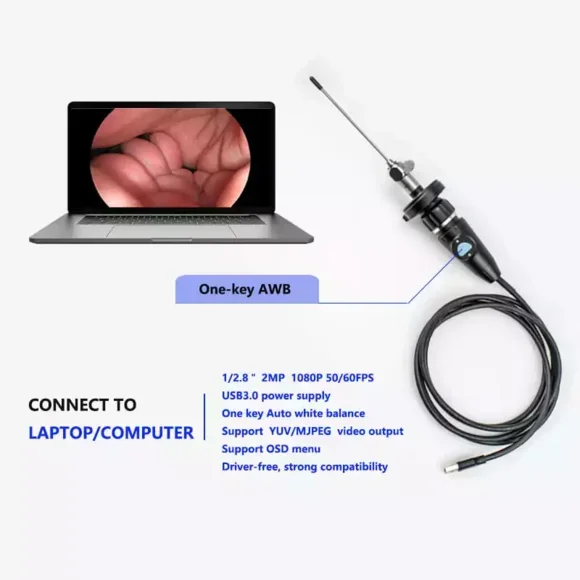 Full HD USB Portable Medical Laparoscope Camera For Endoscopic Ent