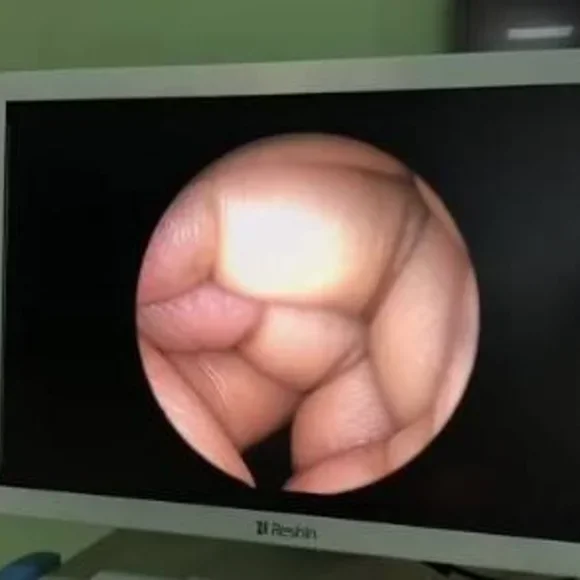 Full HD endoscopy camera