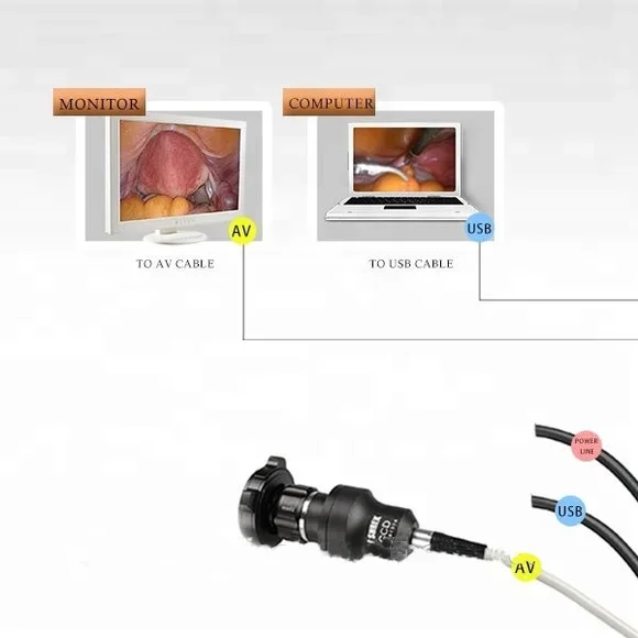 medical portable waterproof USB camera/ENT endoscopy USB portable camera